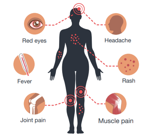 zika-symptoms.png